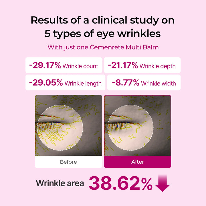 Calcium Eyecare Routine Set | 1+1 Gratis