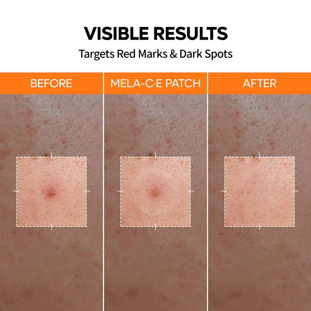 MELA-C·E ZERO FIT Ultra Thin Dark Spot Patch