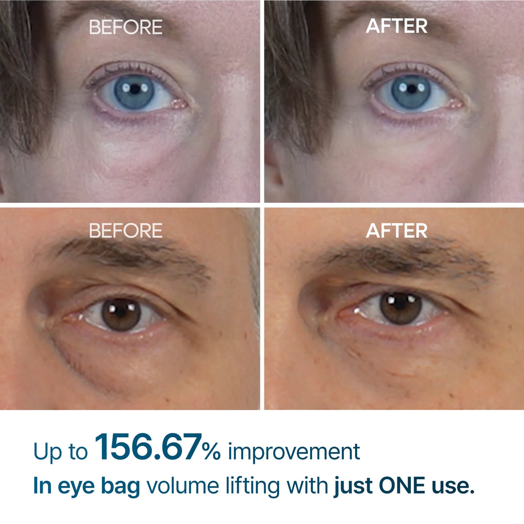 Dr Melaxin Eyephalt eyebag cream | #1 Oplossing voor Onderoog zakken in NL