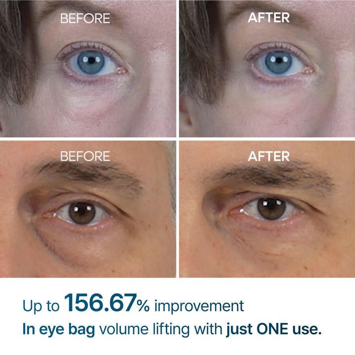 Dr Melaxin Eyephalt eyebag cream | #1 Oplossing voor Onderoog zakken in NL