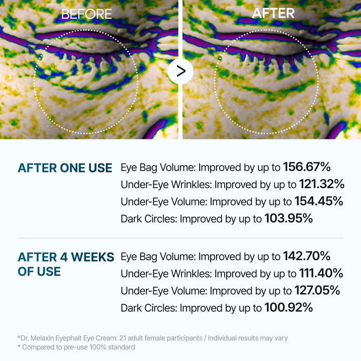 Dr Melaxin Eyephalt eyebag cream | #1 Oplossing voor Onderoog zakken in NL